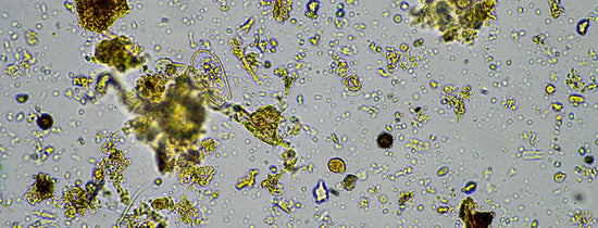 Microbes - Your plants best friends